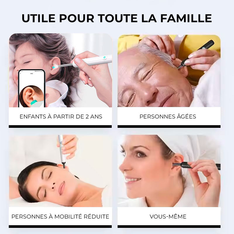 Audiclean - Nettoyeur d'oreille intélligent avec caméra